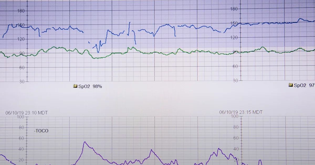 Allostatic Load: Why Chronic Pressure Wears You Down